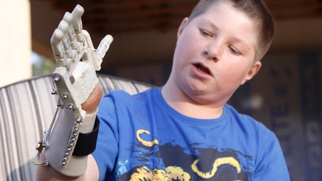 Robohand is made from cables, screws, -D printing and thermoplastic. It uses the rotation of a joint to enable five plastic digits to grasp. The device looks like a robot's hand in a science fiction movie, costs about $ to make and can be reproduced using plans on the Internet.